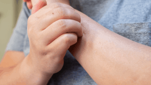 itchy arm